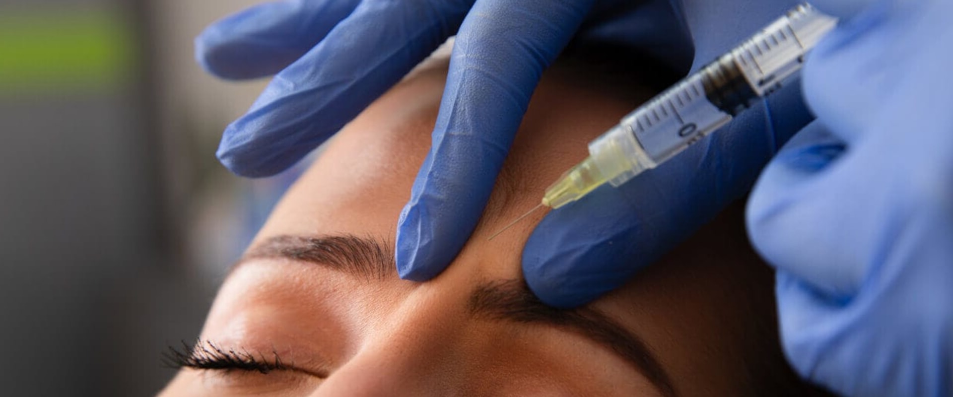 Botox and Fillers for Anti-Aging: The Ultimate Guide