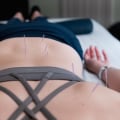 5 Tips for Finding a Reputable Acupuncturist