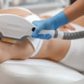 Different Methods of Hair Removal: A Guide to Beauty and Wellness at Med Spas