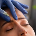 Botox and Fillers for Anti-Aging: The Ultimate Guide