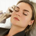 Finding the Right Provider for Injectable Treatments