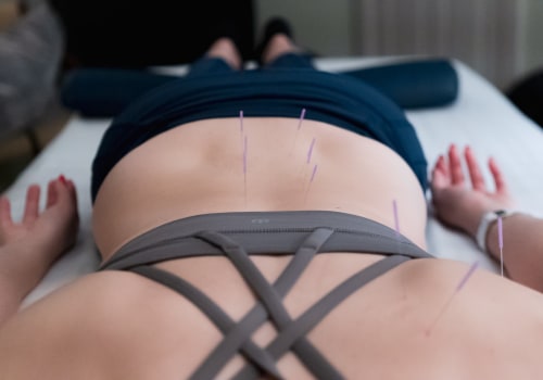 5 Tips for Finding a Reputable Acupuncturist